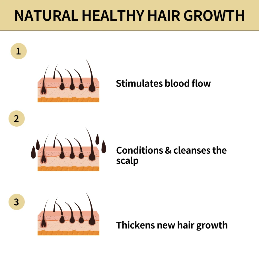 Private Label Natural Organic Rosemary Hair Growth Oil Hair Regrowth ...