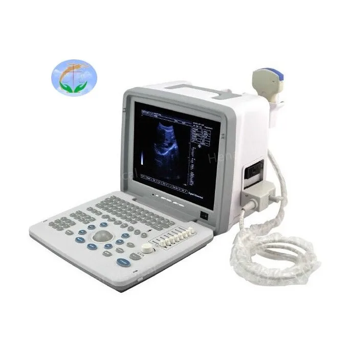 Full Digital UItrasound Diagnostic System Full Digital UItrasound Diagnostic System