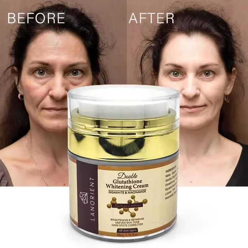 LANORIENT Dark Spot Removing Cream Double Glutathione Light Spot Whitening,  Brightening and Improving Dull Skin Face Cream