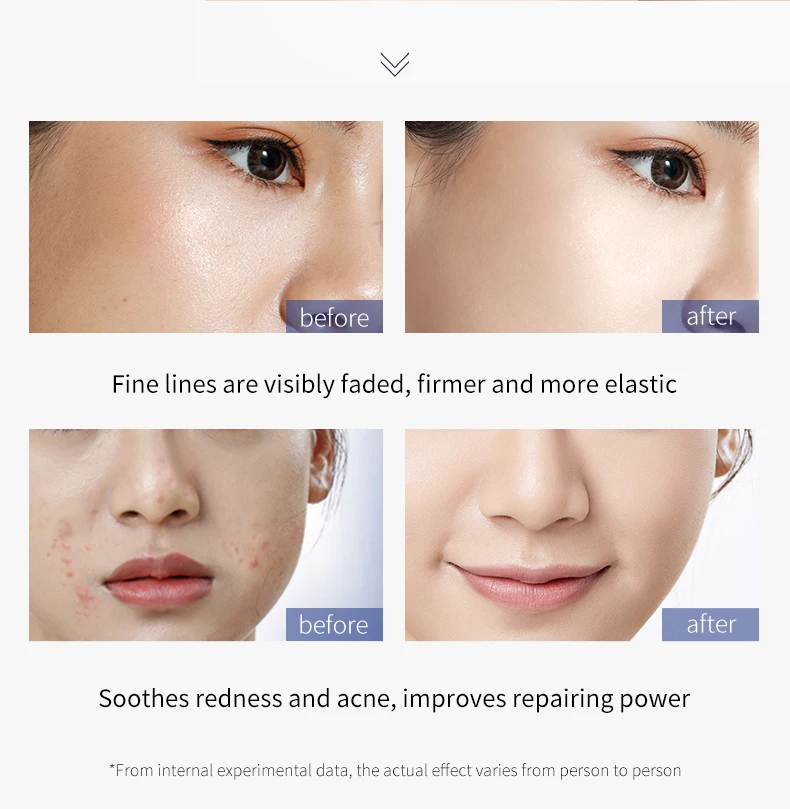 Private Label Organic Whitening Moisturizing Korean Skin Care Sets 5pcs