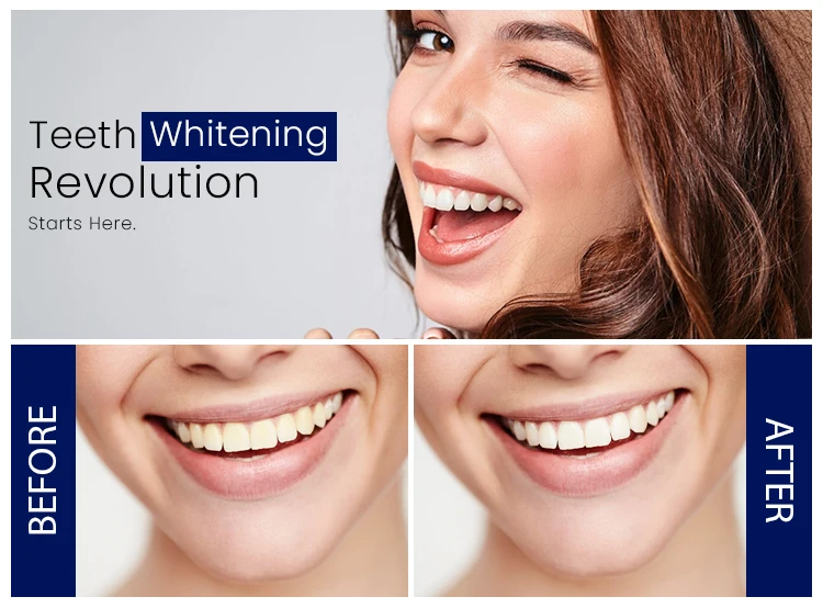 Latest New Collection Product Whitening Strips Crest Bright 24 ...