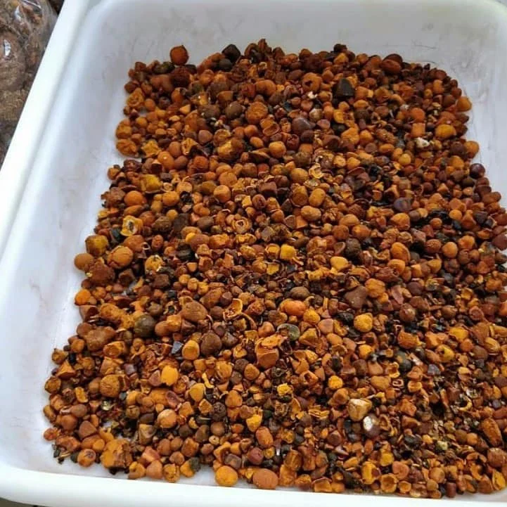 gallstones 3.jpg