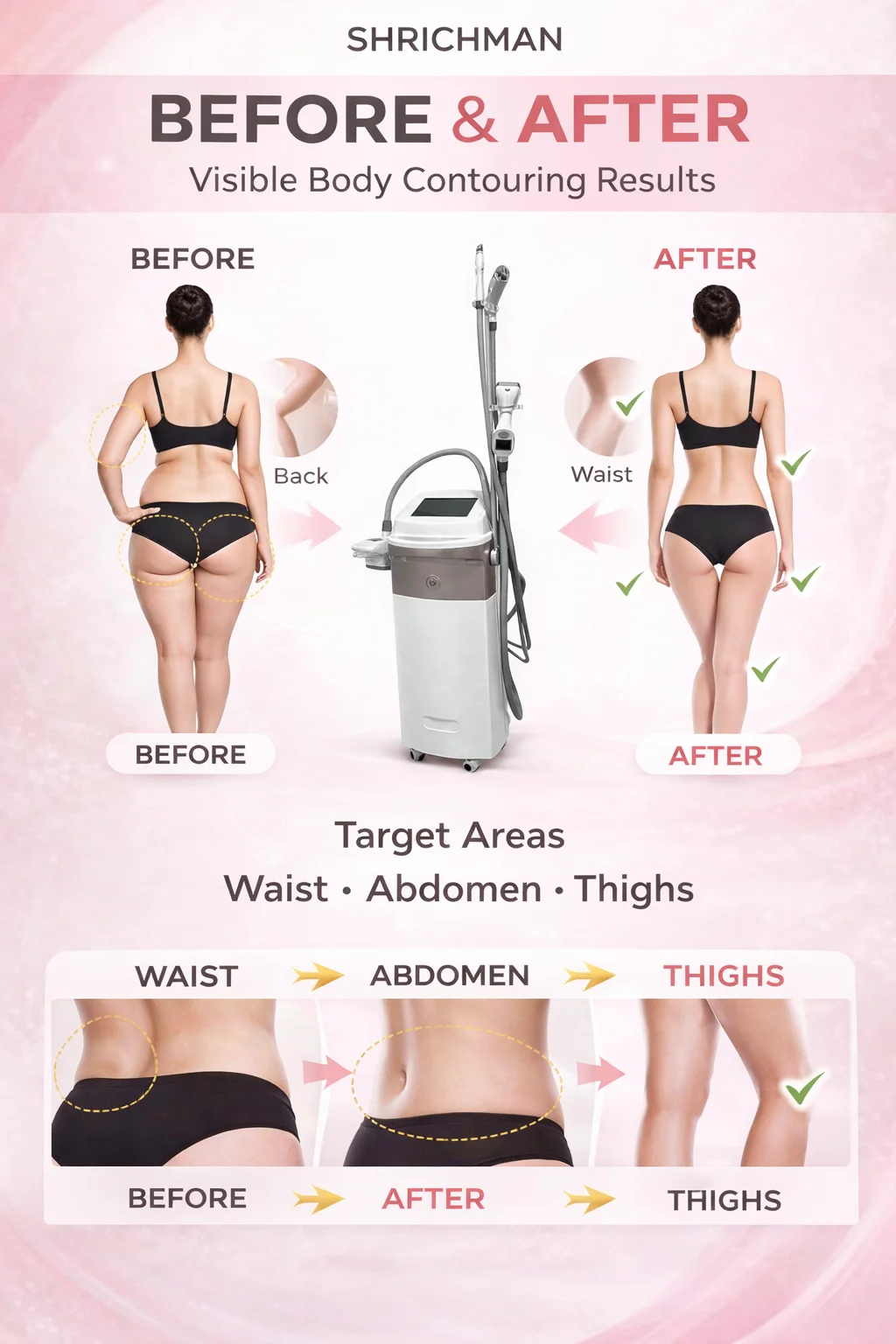 V10 Professional RF Beauty Machine with 4 Handles, Vacuum System and Infrared Light for Body Shaping and Skin Firming