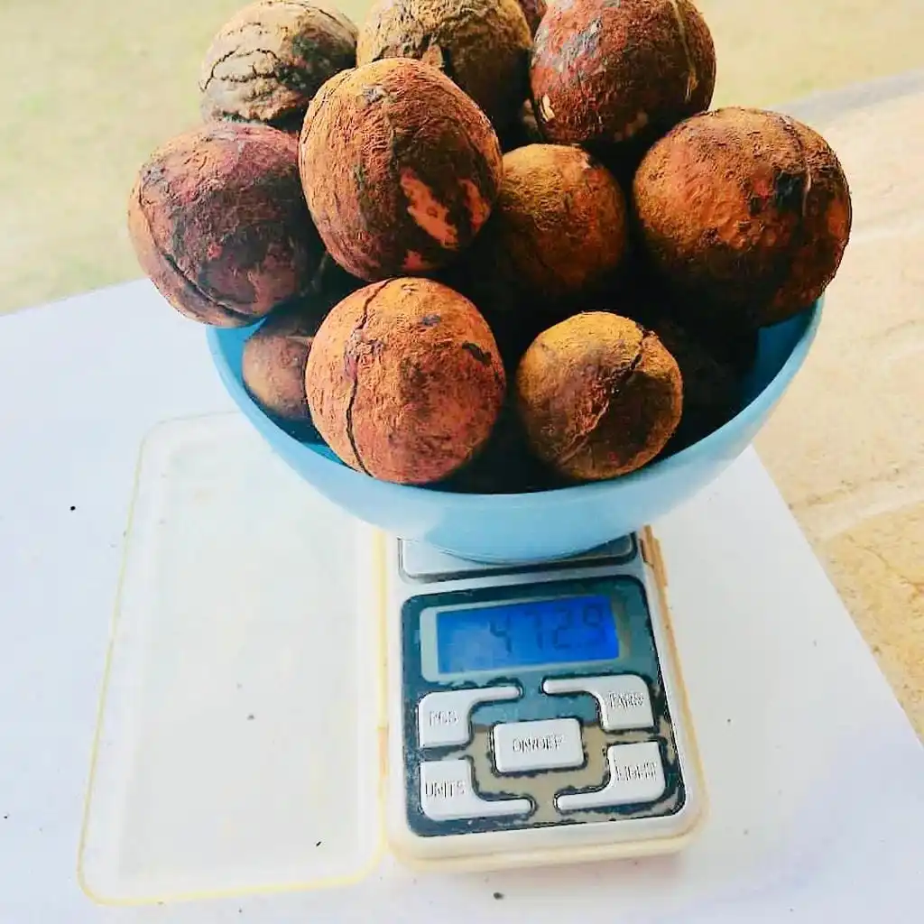 gallstones 6.jpg