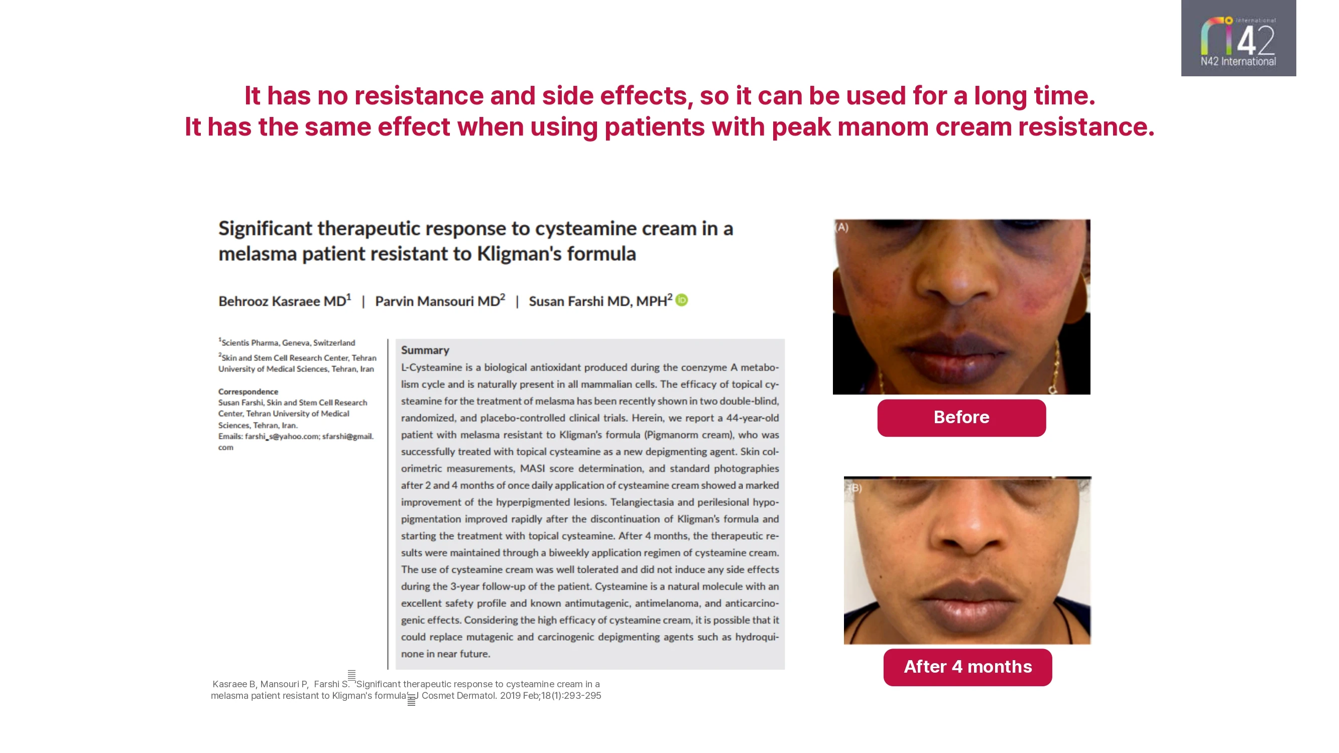 Made In Korea Fomellacys Odt Cream Pack Effect For Removing Melasma And