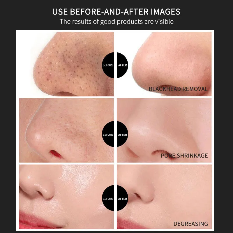 Hot Selling Mineral Nose Mask Deep Cleansing Blackhead Removal Strips for Nose Skin Pores Shrinking Patch Nose Mask
