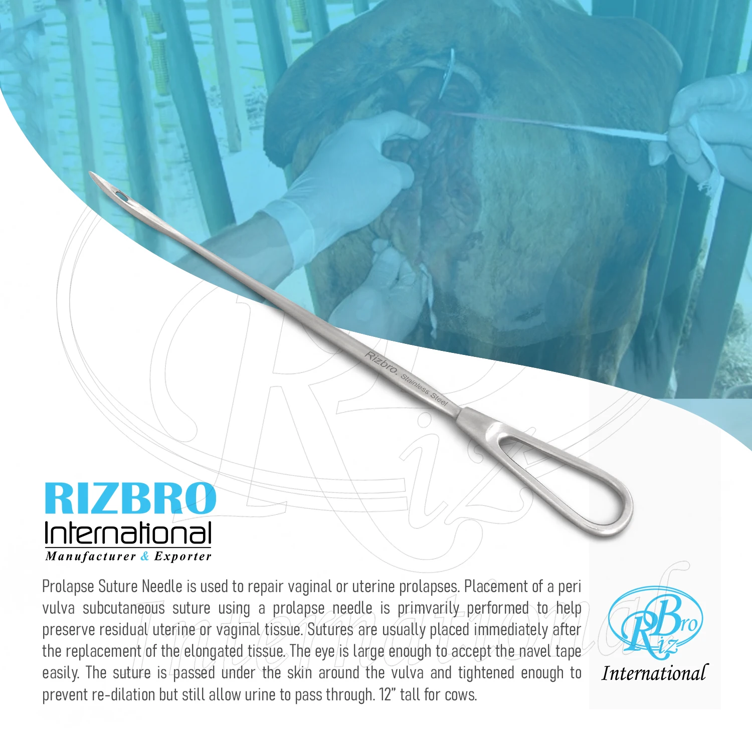 La Chirurgia Del Del Prolasso Di Vescica E Utero - Foto 10