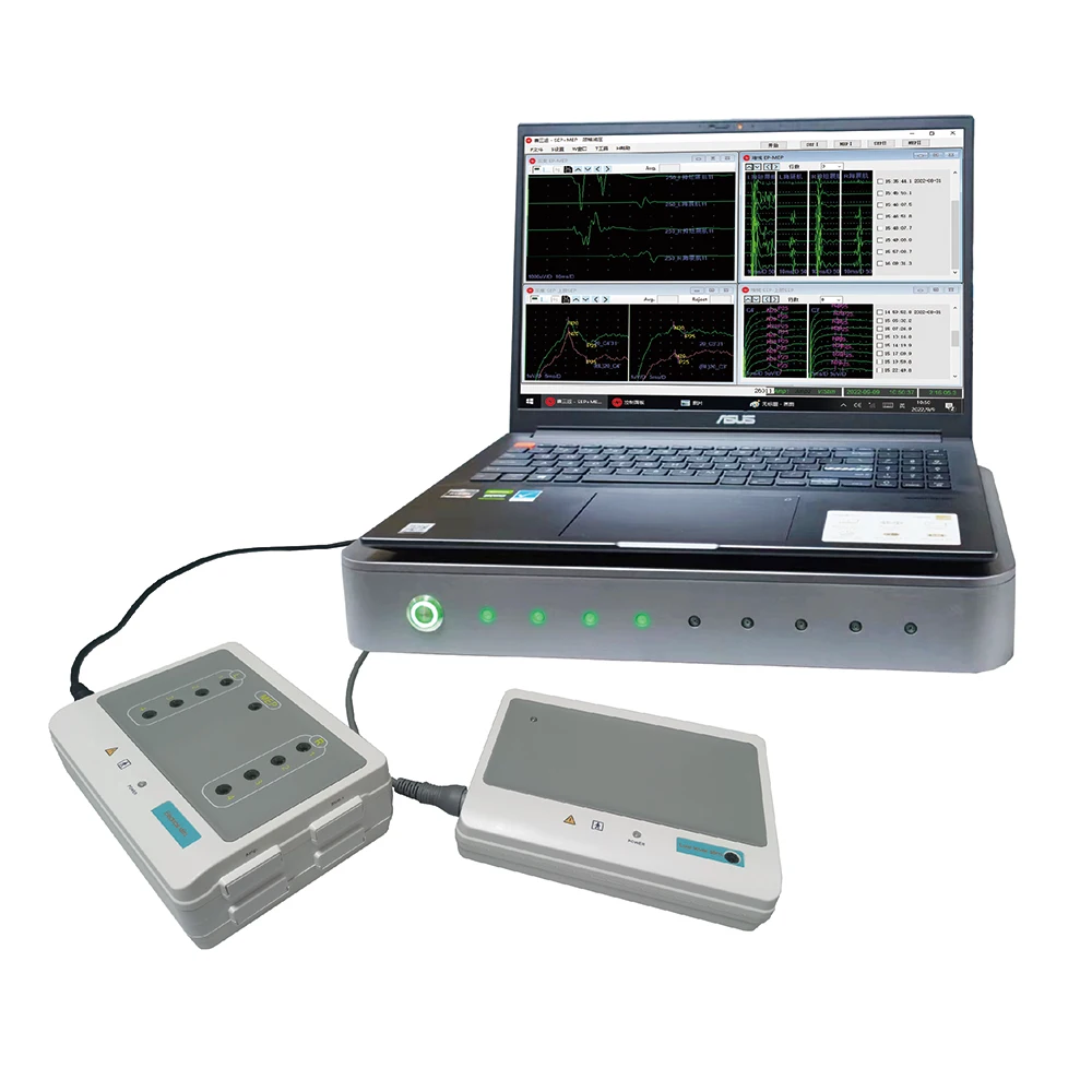 Medical IONM System Nerve Monitoring Systems for ENT/thyroid Surgery for Sale Surgical Equipment