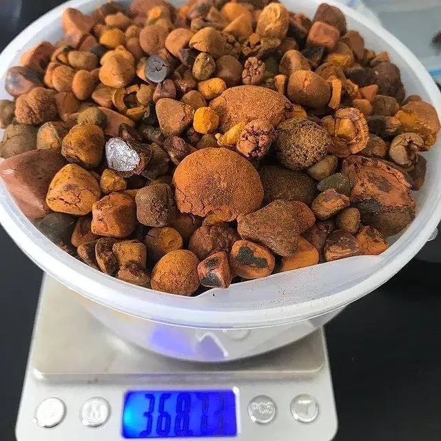 gallstones 5.jpg