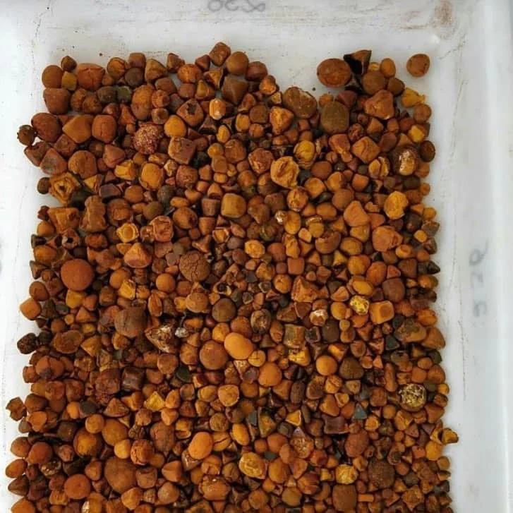 gallstones 2.jpg