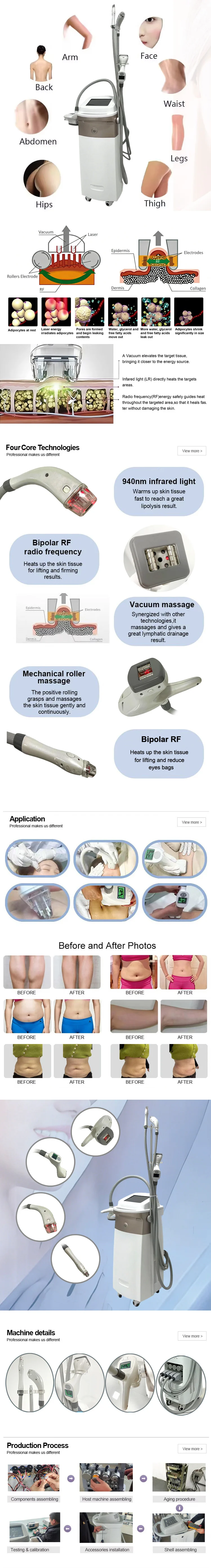V10 Professional RF Beauty Machine with 4 Handles, Vacuum System and Infrared Light for Body Shaping and Skin Firming