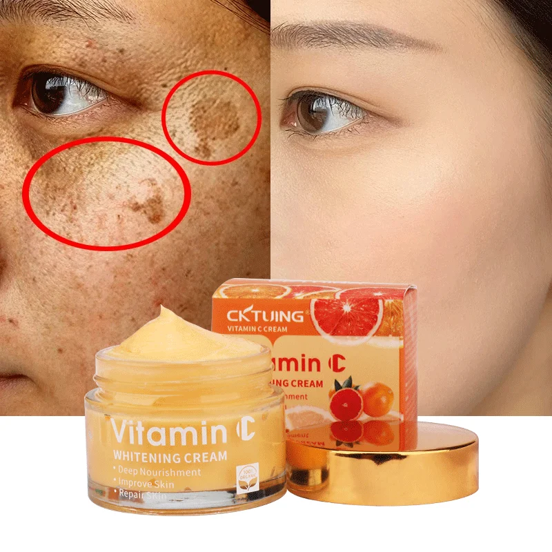 Private Label Organic Arbutin Vitamin C Anti Wrinkles Moisturizer Bleaching Whitening Black Spot Face Cream