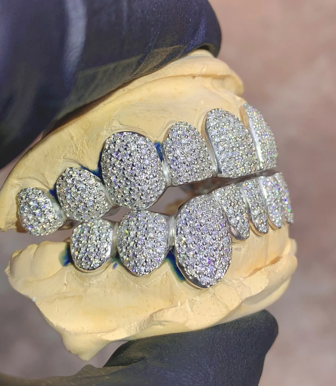 Custom Grillz Vvs Moissanite /lab Diamond Iced Out Top And Bottom 10k