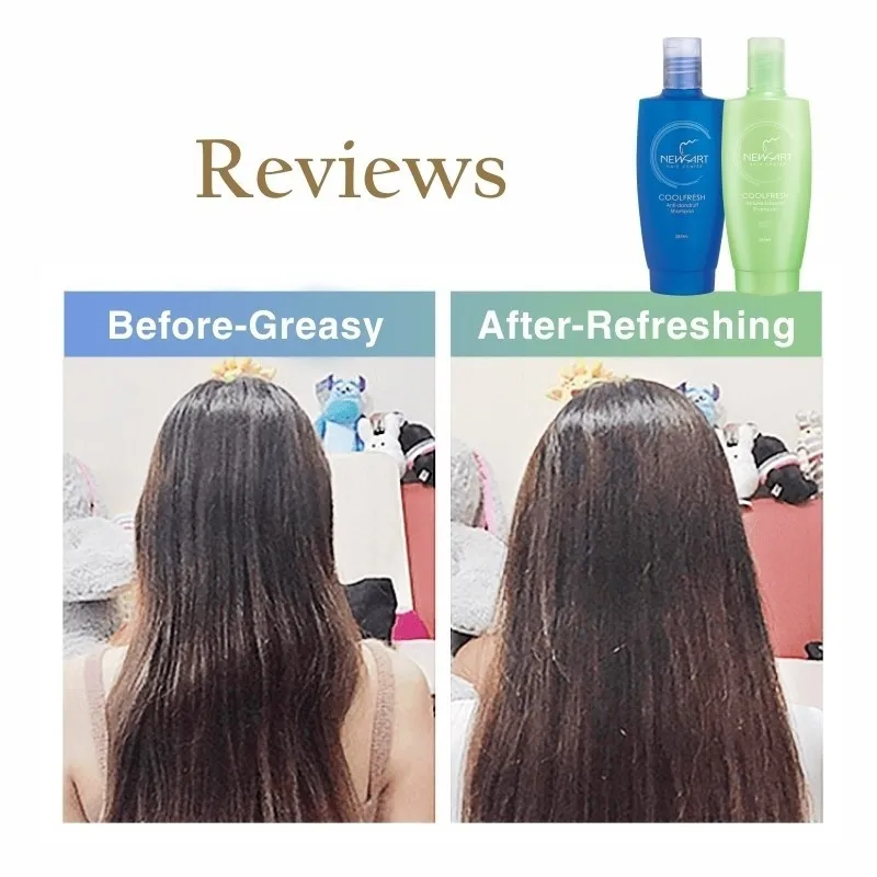Scalp Treatment Coolfresh Anti-dandruff and Sense Dandruff Control and Anti Hair Loss