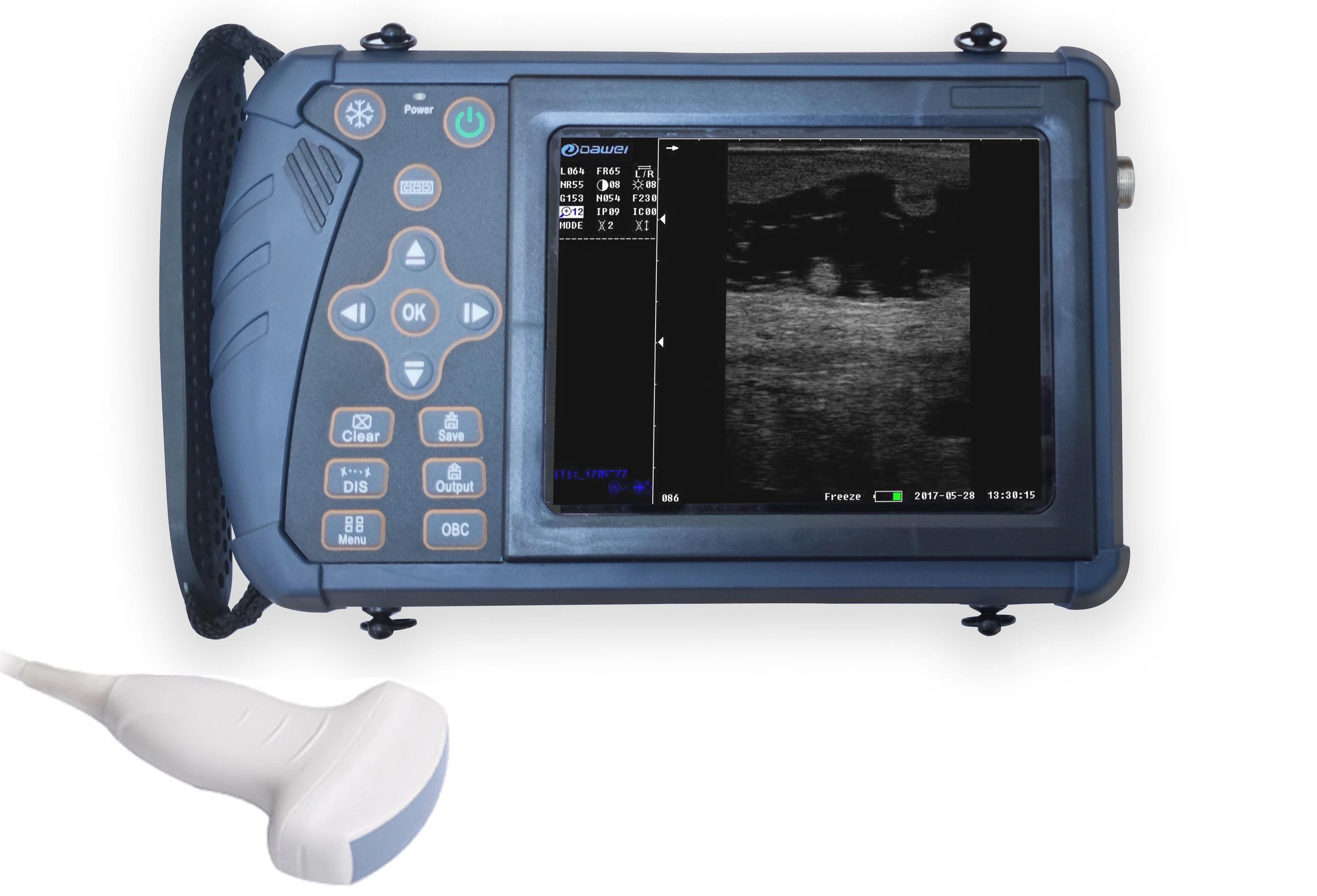 Portable Full Digital Veterinary Ultrasound Pregnancy Ultrasound ...