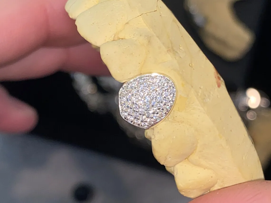 Custom Grillz Vvs Moissanite /lab Diamond Iced Out Top And Bottom 10k