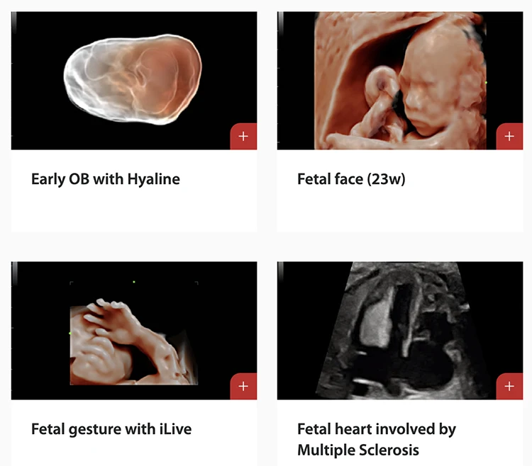 Mindray DC-70 USG Machine Medical Ultrasound Instruments Mindray DC 70 Ultrasound Machine With Trolley