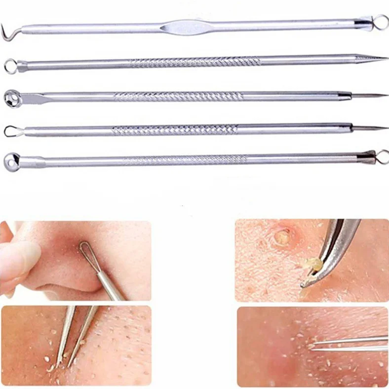 Set of 5 Comedone Extractors for Blackhead and Blemish Aesthetician Approved Pimple and Whitehead Facial Acne Tools-with Case