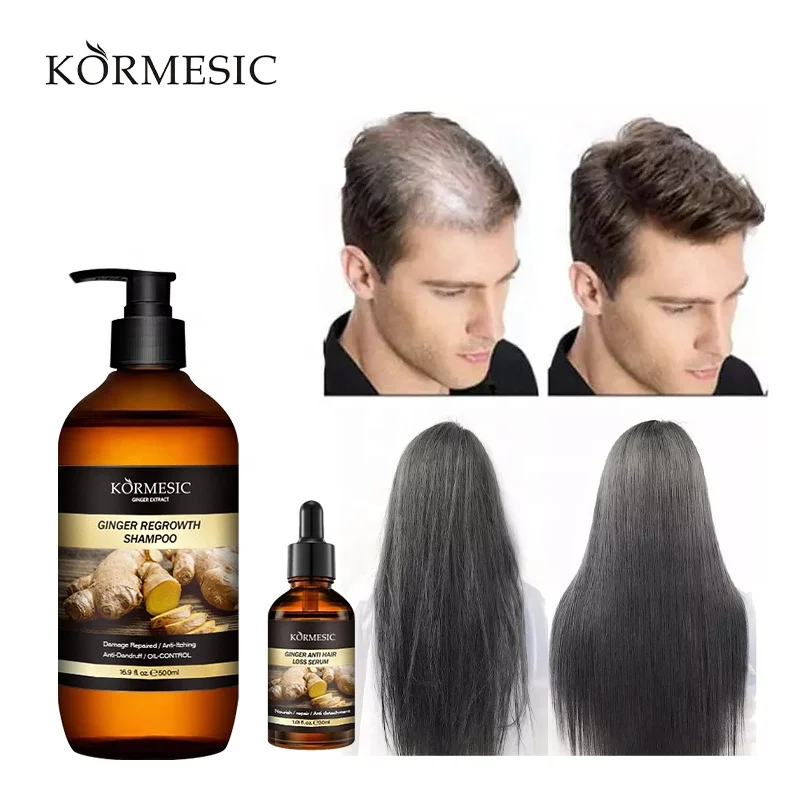 OEM ODM Private Label Hairline Control Scalp Hair Follicles Repair Promote Hair Growth Nourishing Ginseng Shampoo