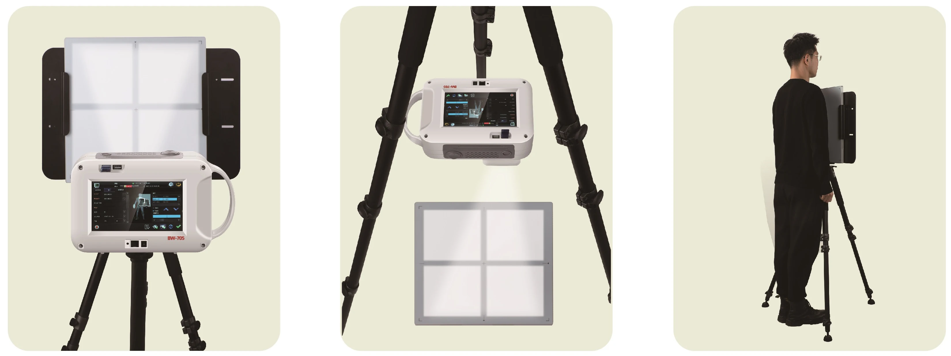 Hot Sale Radiology Equipment Minimize Radiation Portable X Ray Machine System supplier