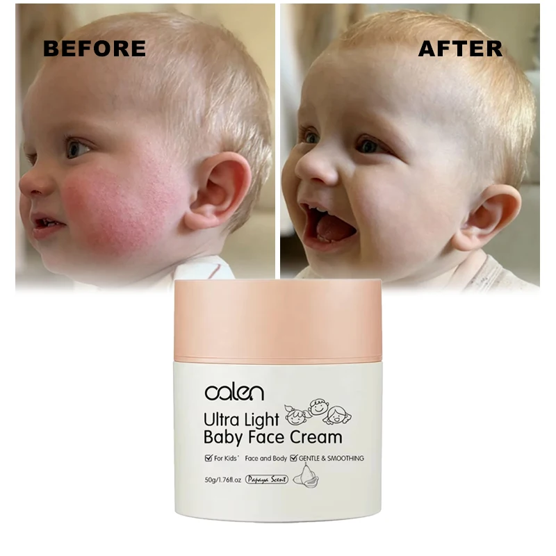 Оптовая продажа, увлажняющий крем для детского лица oala без спирта, мягкий крем для малышей, защищает детскую кожу, крем для лица