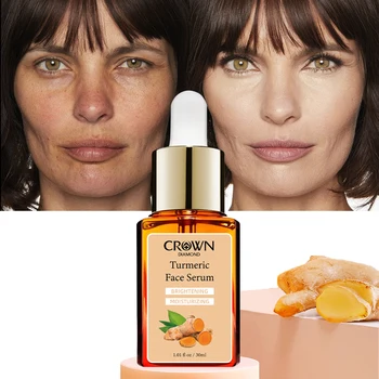 Private Label Organic Vitamin C Spot Pigment Moisturizing Anti Oxidant Aging Wrinkle Whitening Turmeric Facial Skin Care Serum