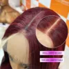 Wig 03