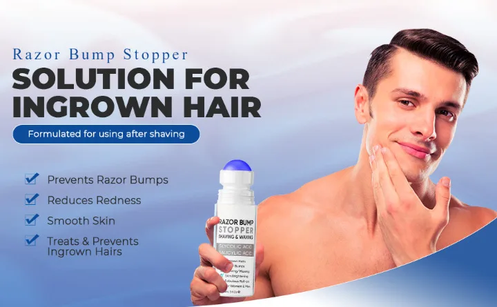 After Shave Skin Care Razor Bumps Treatment Solution For Ingrown Hair ...