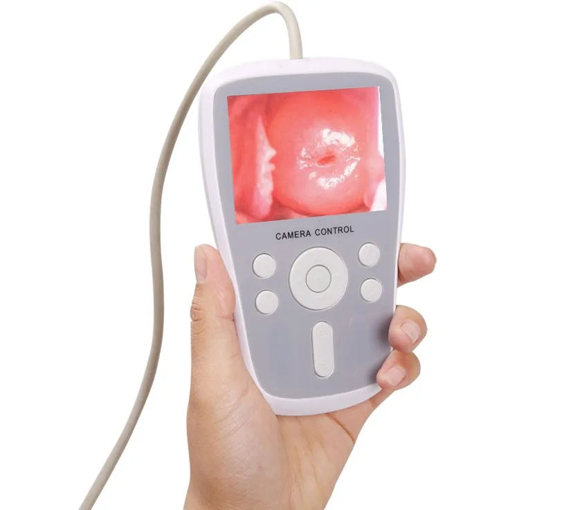 Sin-ay08portable Handheld Gynecology Colposcopy System Digital ...