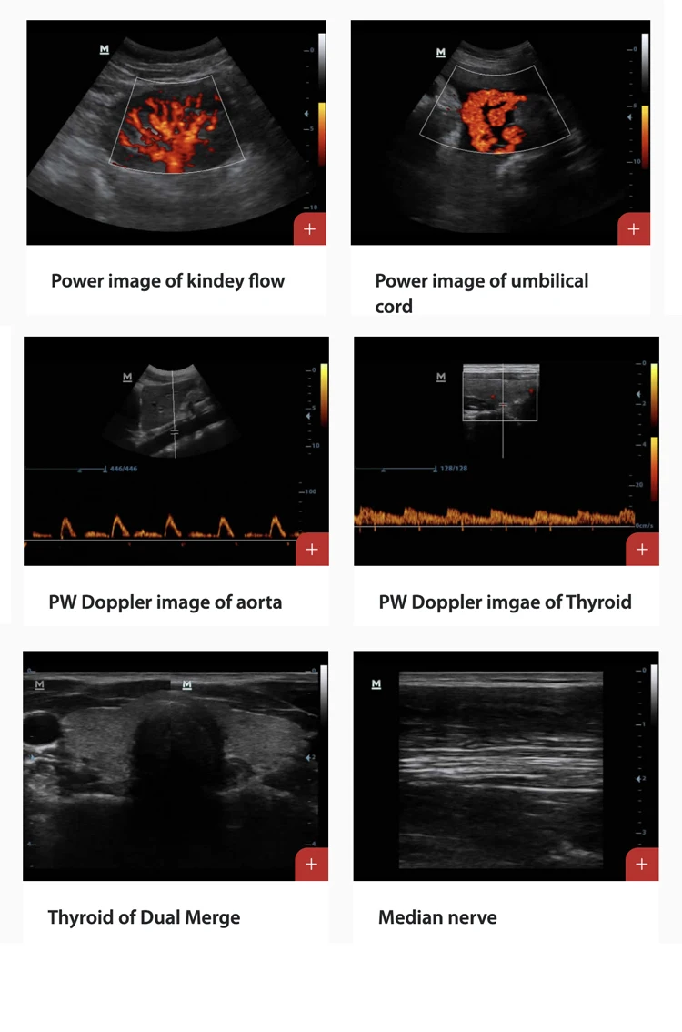 Mindray Dp-20 Dp-30 Dp-50 Portable B/w Ultrasound Machine Usg Digital ...