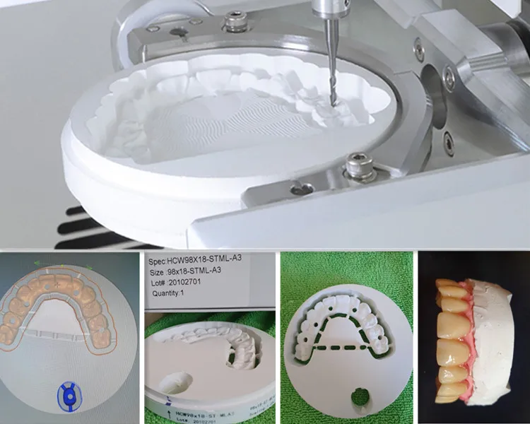 STML Dental Lab Material Multilayer Zirconia Blocks Price Manufacturing Supplier for Cadcam Ceramics Dental Zirconia Disc