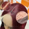Wig 04