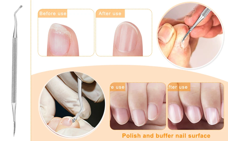 In Growing File Ingrown Toenail File Double Sided Toenail Lifter One Side Flat And One ...