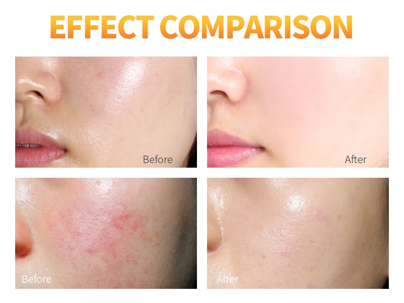 Disaar Vitamin C Skin Whitening Brightening Face Cream Day And Night