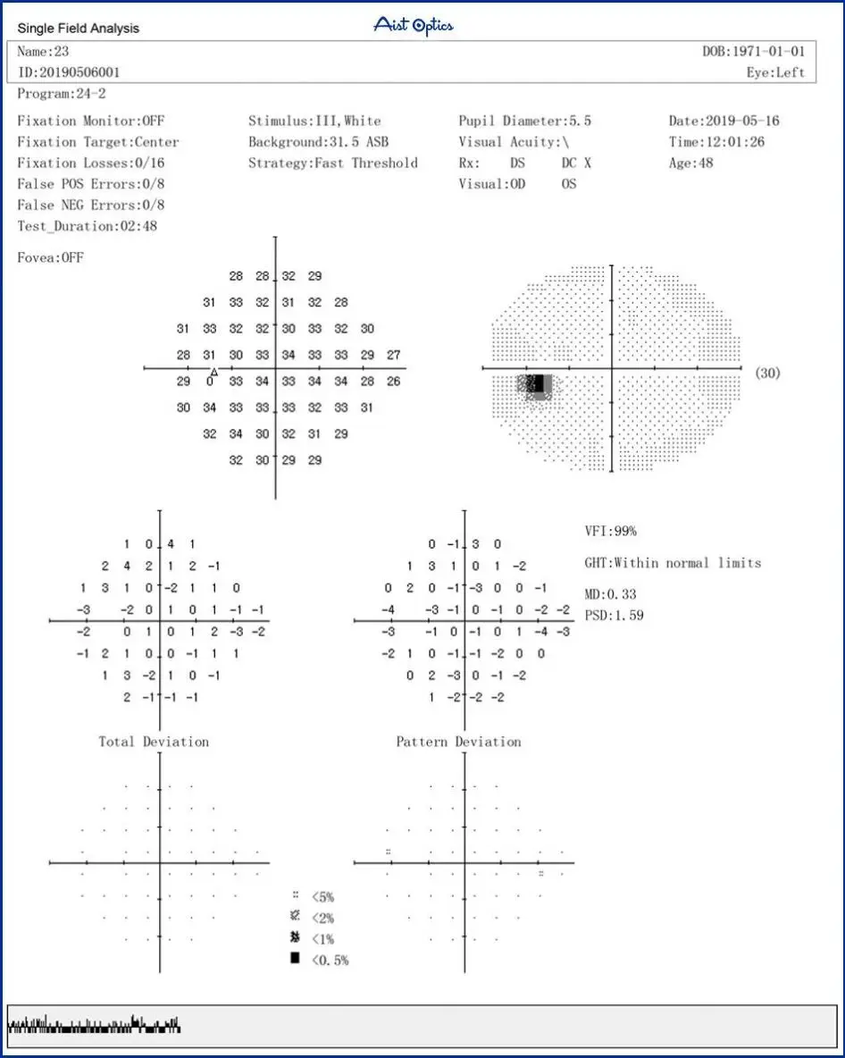 Humphrey Visual Field Analyzer Electric Metal Ophthalmic Projection Perimeter BIO-1000