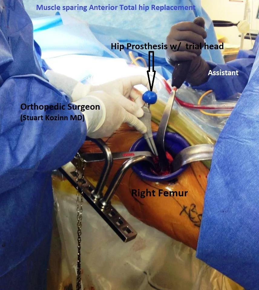 Moore Femoral Head Extractor with T Handle - Orthopedic Instrument