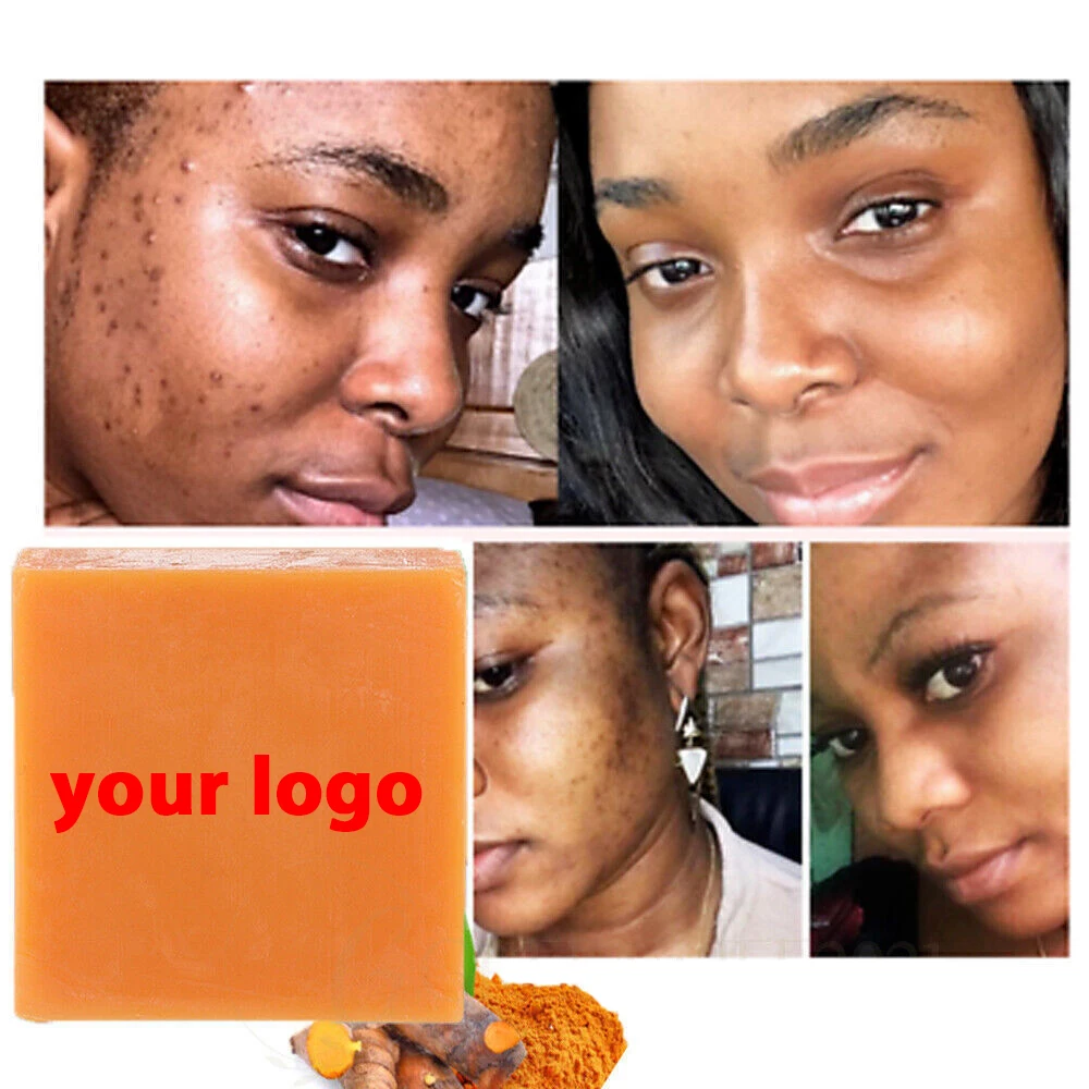 Natural Essential Oil Ginger Bar Soap For Face & Body Reduces Acne