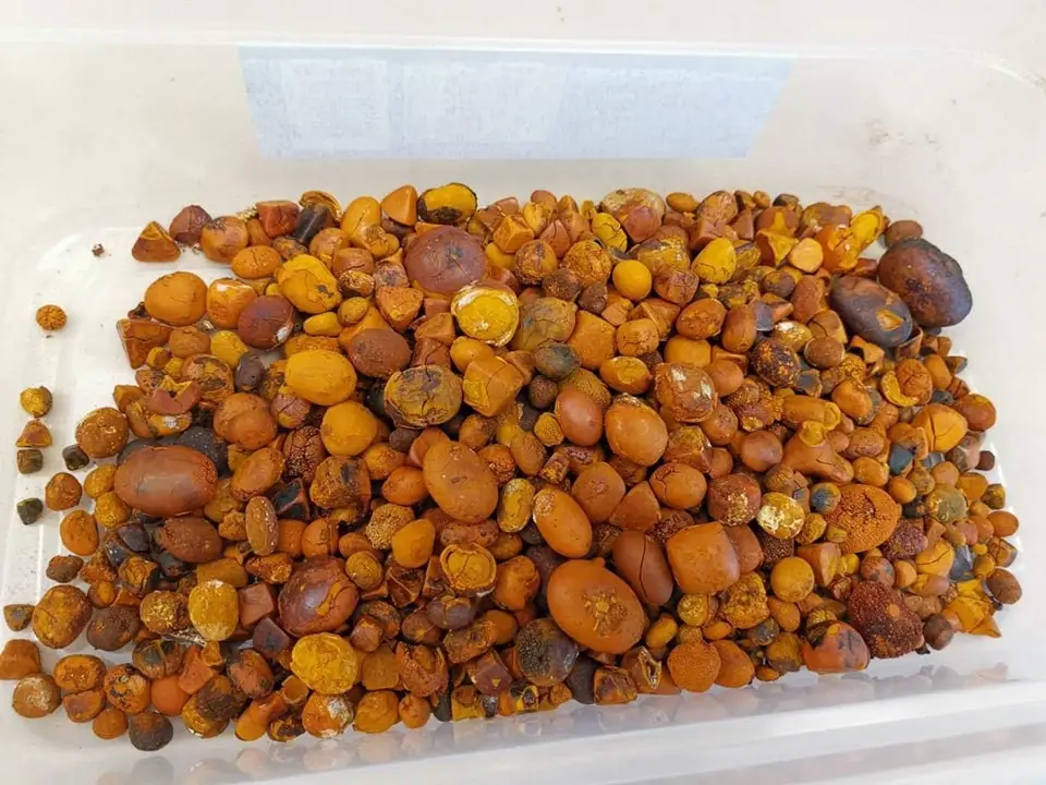 gallstones 4.jpg