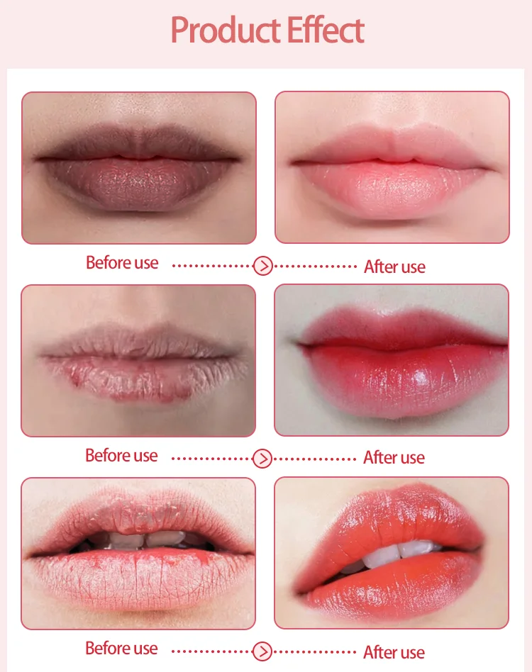 Moisturizes And Repairs Dry Chapped Lip Treatment Balm Moisturizing