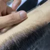 Personalizado
