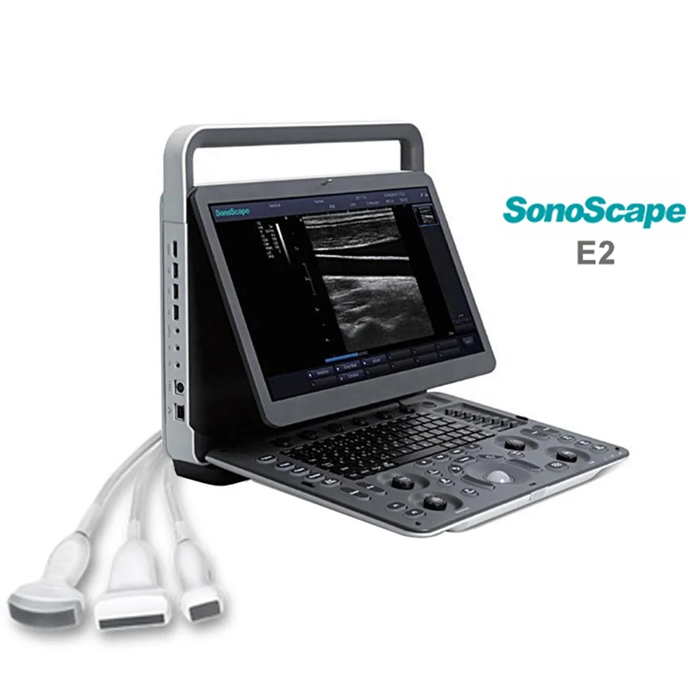 Msk Ultrasound Tdi Cw Color Sonoscape E2 E3 & Sonoscape E1 Usg - Buy ...