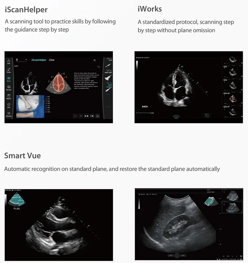 Mindray Consona N6 N7 N8 N9 Color Doppler Ultrasound Cardiovascular Obstetrics Gynecology Urology USG Machine