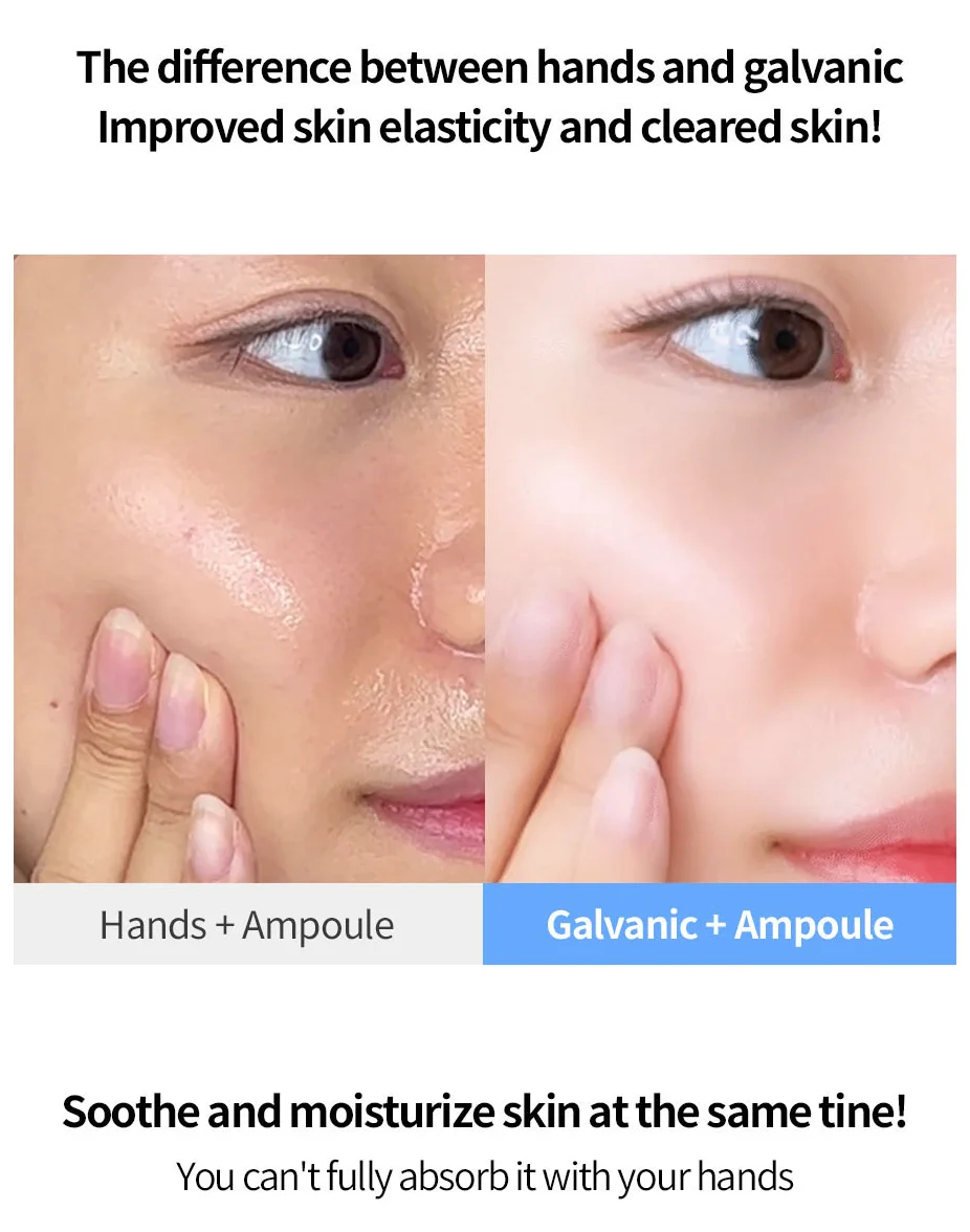 Face Factory Galvanic Z Waterpeeling Machine [made In Korea/beauty