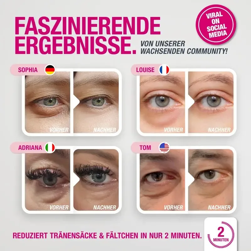 Faszinierende Vorher Nachher Ergebnisse von der Social Media Community Sophia Louise Adriana Tom