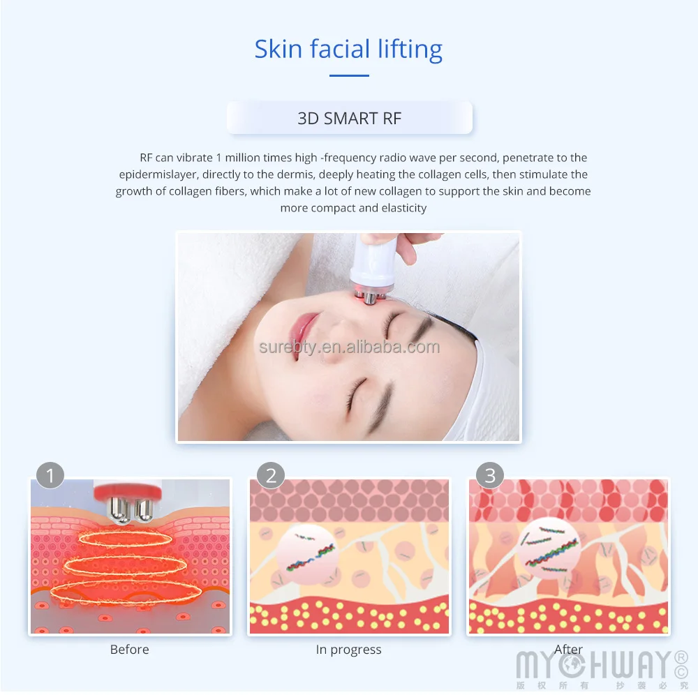 2 In1 Mini Rf Radio Frequency Facial Wrinkle Removal Anti Aging Beauty