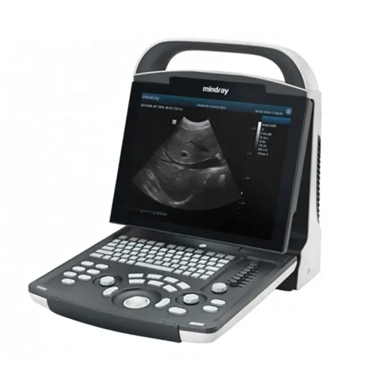 Mindray Dp-20 Dp-30 Dp-50 Portable B/w Ultrasound Machine Usg Digital ...