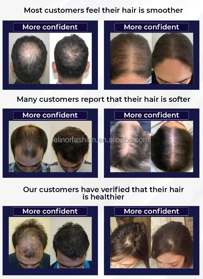The Latest Inventions of China Ginseng Extract Polygonum YUDA Hair Growth Spray/ FEG Pilatory