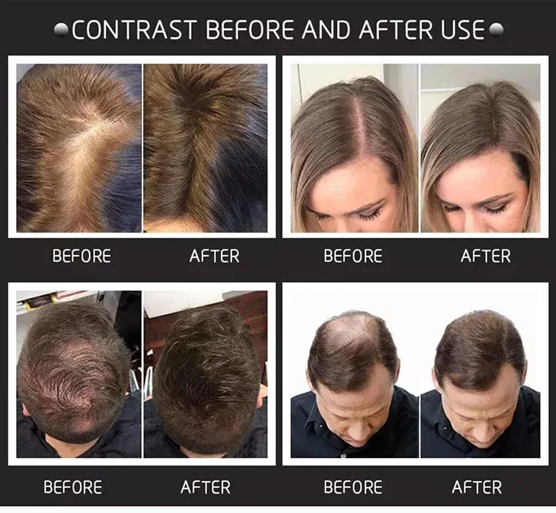 3pcs Set 27.5g Topik Hair Building Fibers Spray Applicator Pump