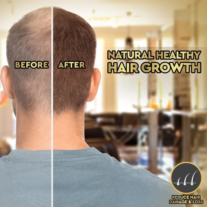 ghk-cu hair before and after Ghk Before and After Hair