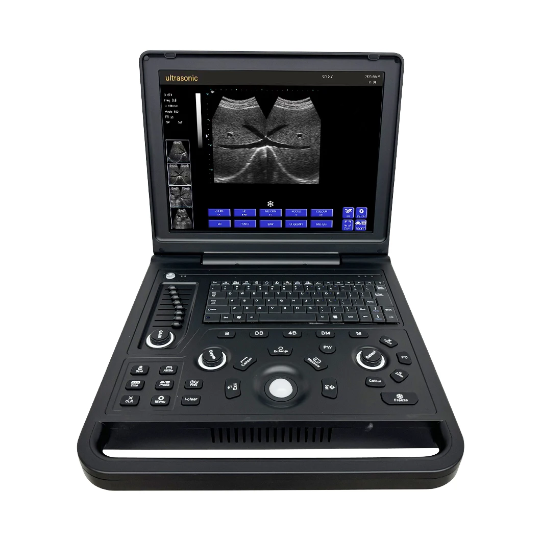 CE Approved Hospital Diagnostic Ultrasound Scanner Equipment Medical Portable Ultrasound Machine